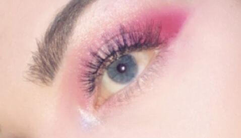 Does the white of my eye look yellow?