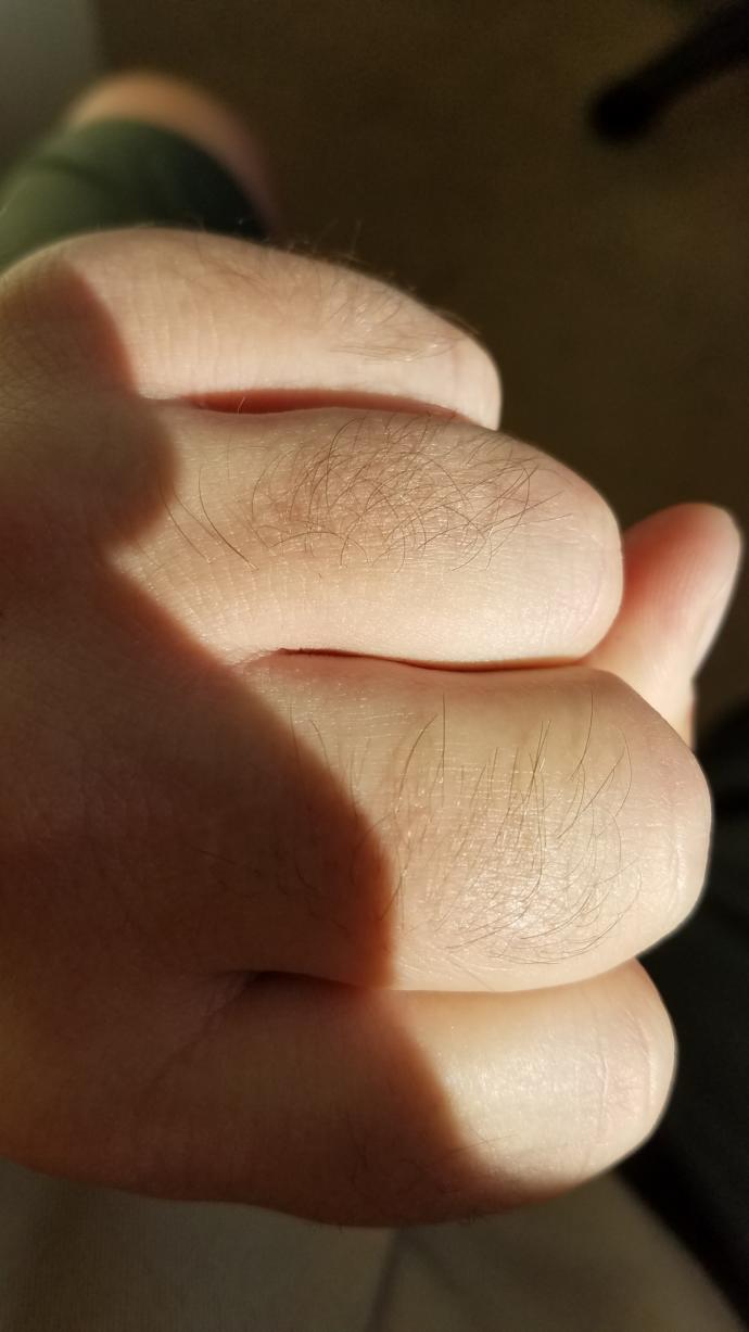Do you have hair on your knuckles? Do you remove them? GirlsAskGuys