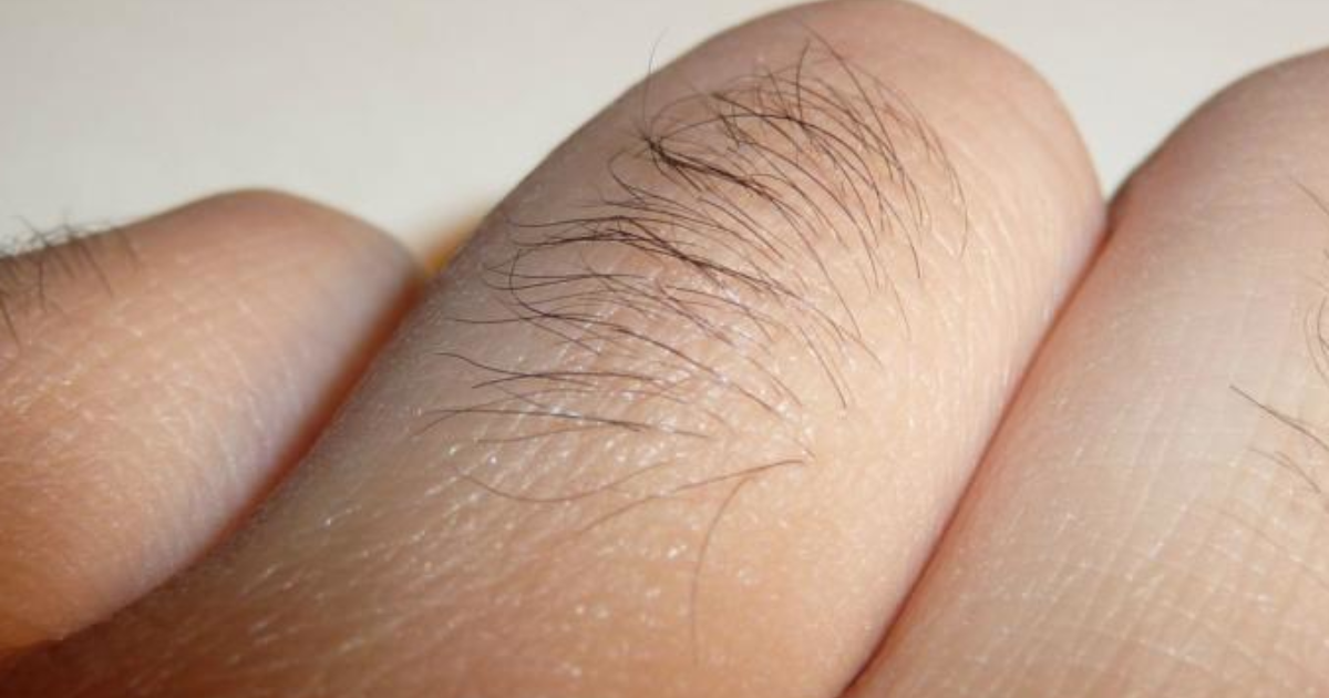 Do you have hair on your knuckles? Do you remove them? - GirlsAskGuys