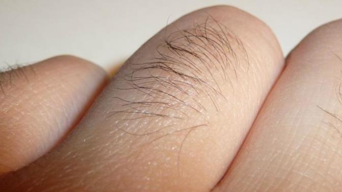 Do you have hair on your knuckles? Do you remove them?