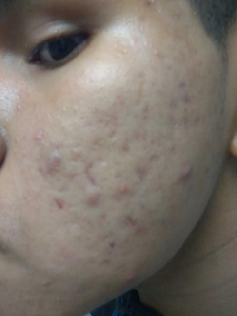 Whay is my skin soft but shows this stuff?