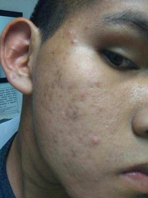 Whay is my skin soft but shows this stuff?