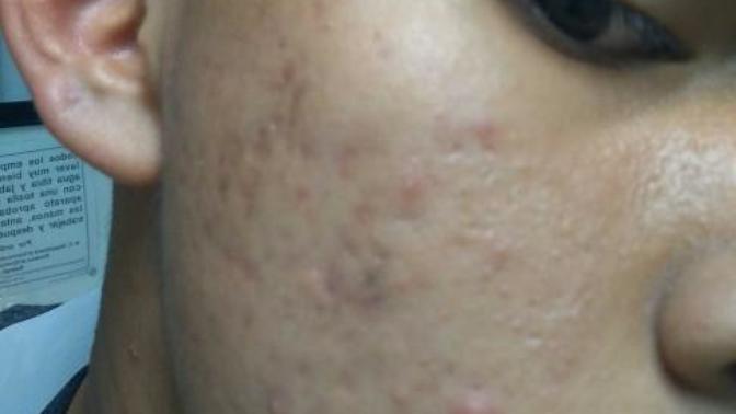 Whay is my skin soft but shows this stuff?