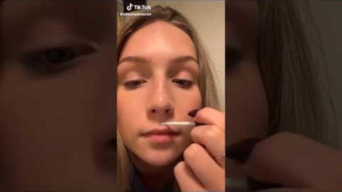 What Are Your Thoughts On This: Teens are super-gluing their lip in the latest social media trend?