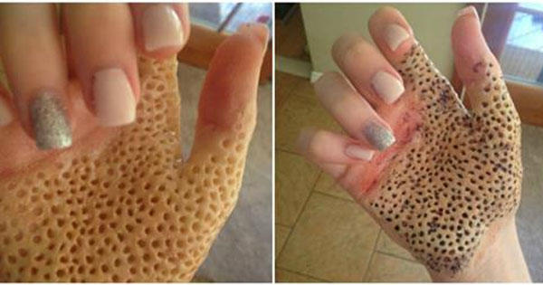 Do you think Apple's Iphone 11 series are triggering trypophobia?