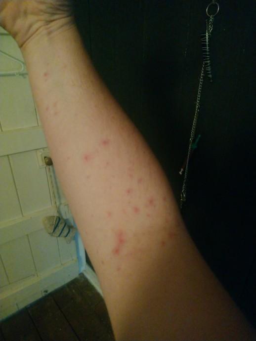 Should I see a Doctor?