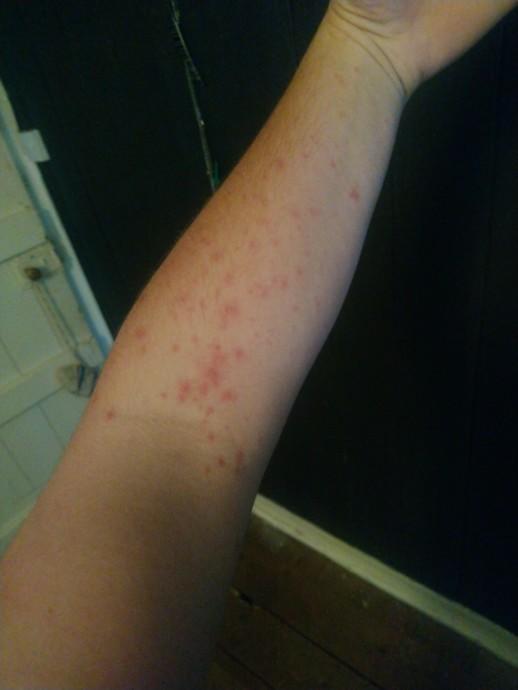 Should I see a Doctor?