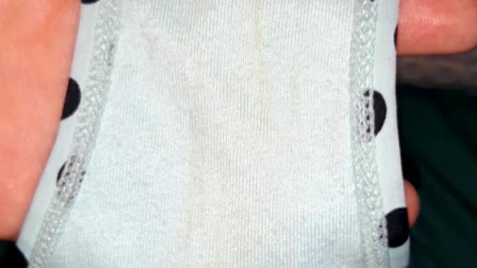 Do these faint yellow stains look like I accidentally wet myself? Warning: picture?
