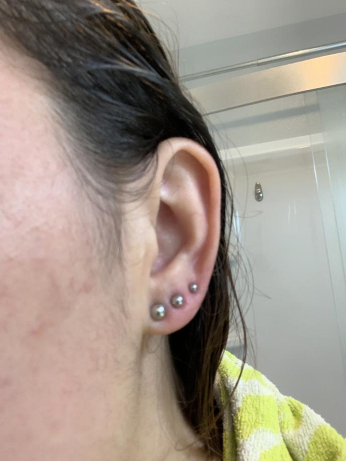Two days into an ear piercing. do they look infected? - GirlsAskGuys