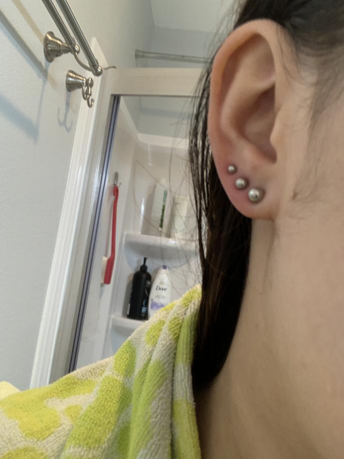 Two days into an ear piercing. do they look infected? - GirlsAskGuys