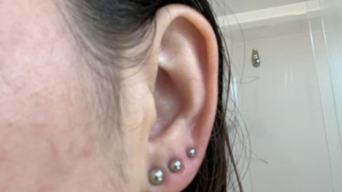Two days into an ear piercing. do they look infected?