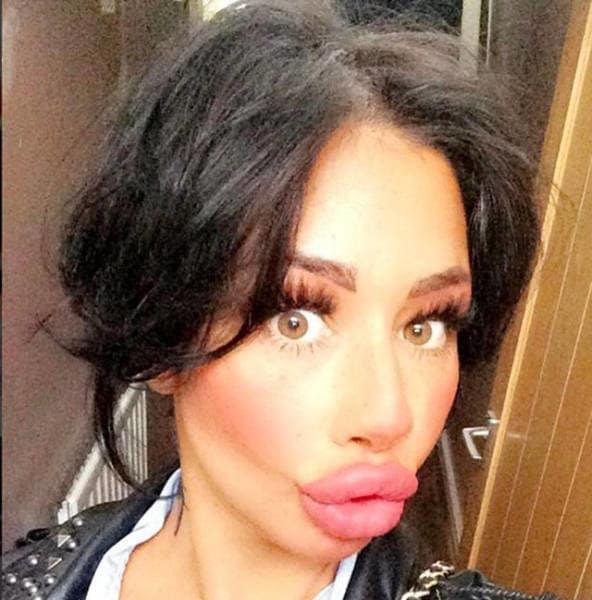 Why do some women think they look more attractive with huge unnatural lips?