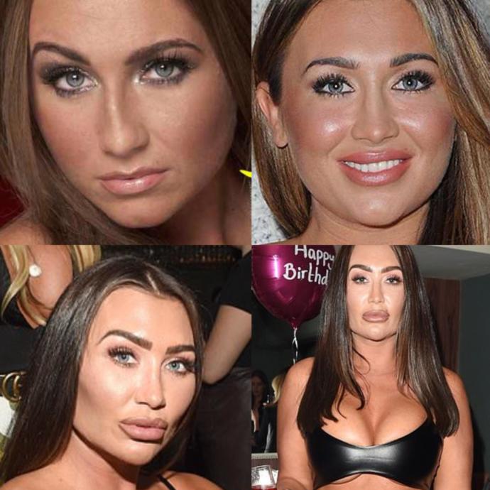 Why do some women think they look more attractive with huge unnatural lips?