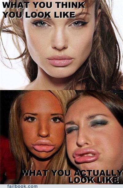 Why do some women think they look more attractive with huge unnatural lips?