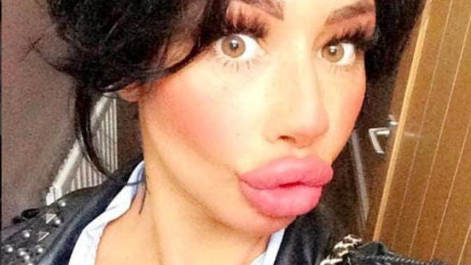 Why do some women think they look more attractive with huge unnatural lips?