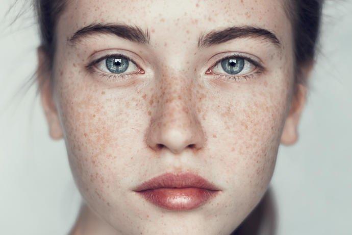 What do guys think of Freckles?