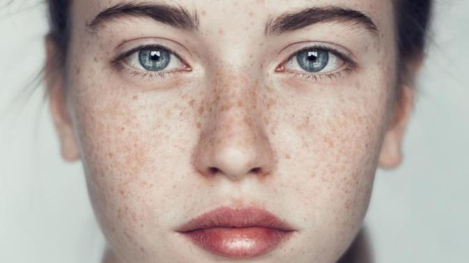 What do guys think of Freckles?