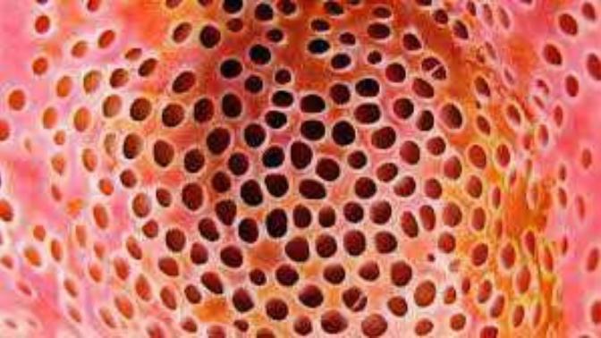 Do you have trypophobia?