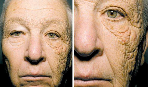 Why do people generally look better tan?