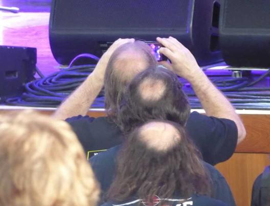 Can balding men still be attractive?
