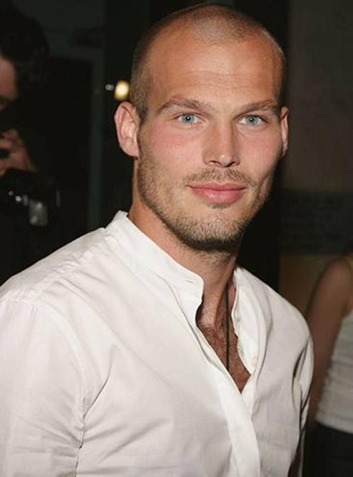 Can balding men still be attractive?