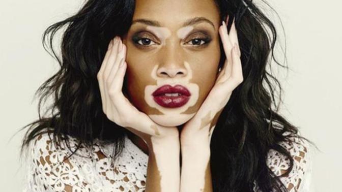 Would you date someone who has a good personality but also has some flaws in their appearance?