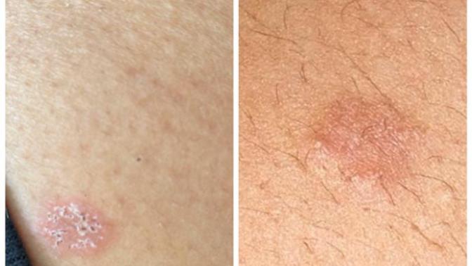 Anyone know what this is and what I can do about it? it’s worrying me?