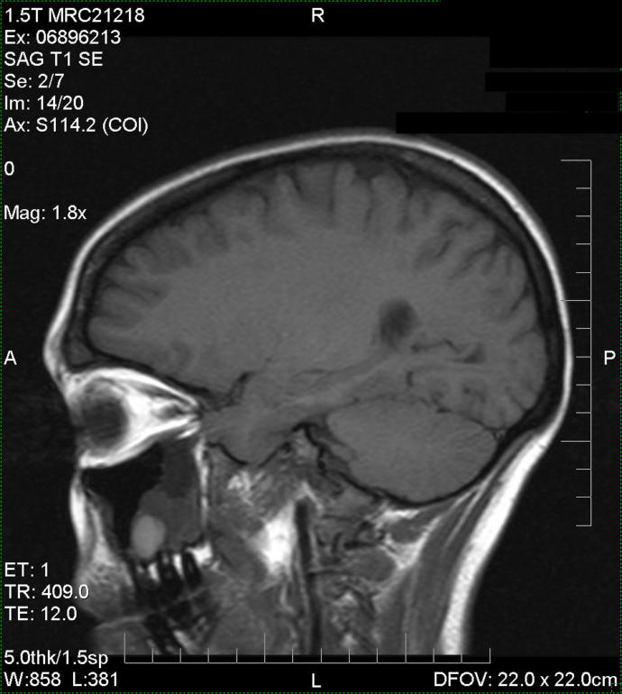 Nope, that's not a tumour.