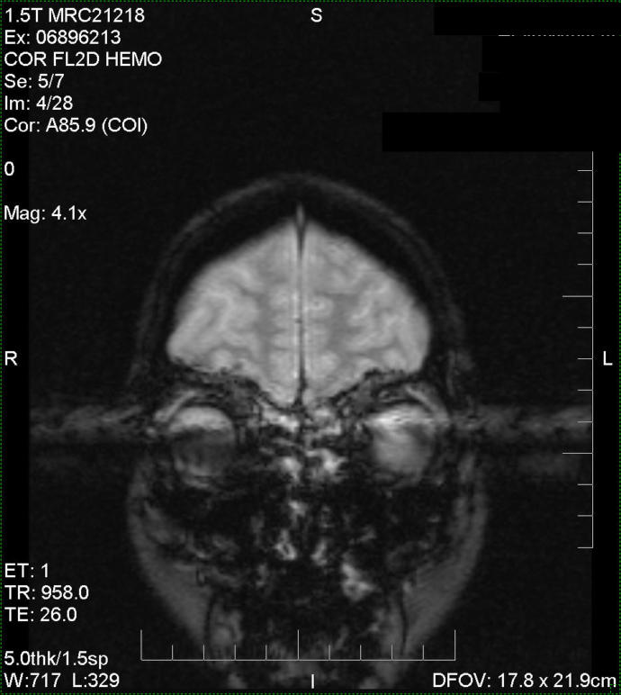 Spooky. Looks like Darth Vader coming out of a lake.