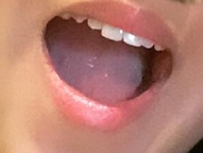 How much do teeth matter in someone you're looking to date?