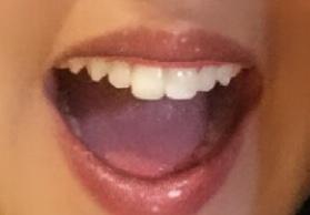 How much do teeth matter in someone you're looking to date?