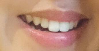 How much do teeth matter in someone you're looking to date?