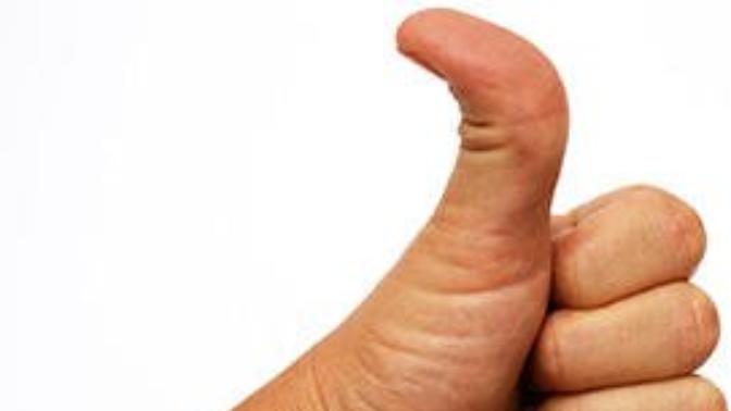 Do you have a hitchhiker’s thumb?