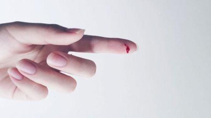 Which is worse: a splinter or paper cut?