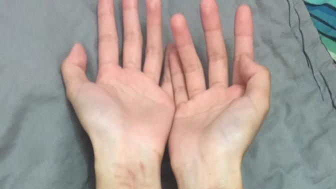 What do you think when you see a girl with clear self-harm scars on her body or arms/legs?