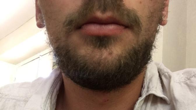 What are your honest opinions on my beard?
