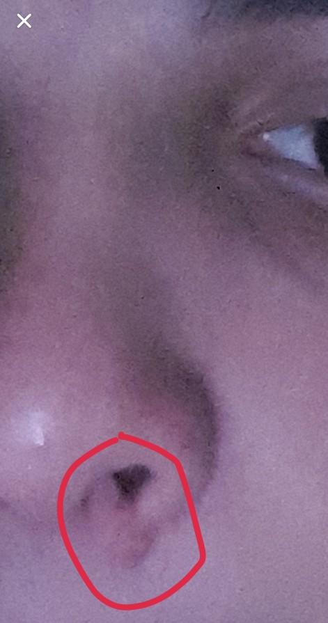 Can somebody please tell me what this is and how I can remove it?