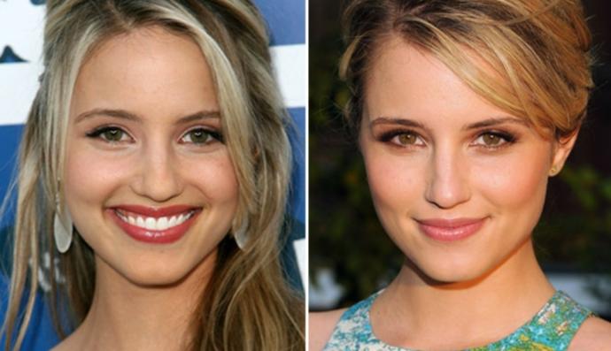 Would you negatively judge someone who had a nose job?