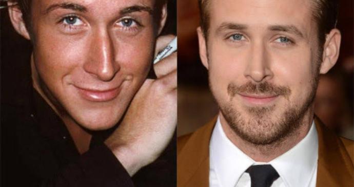 Would you negatively judge someone who had a nose job?