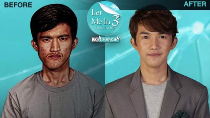 What do you think of South Korean plastic surgery?