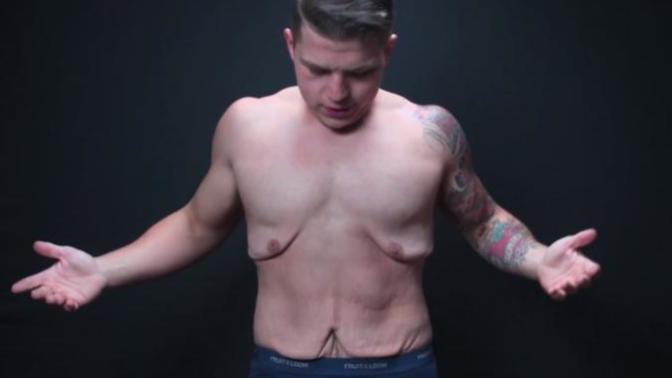 Would you date someone who has loose skin from weight loss?