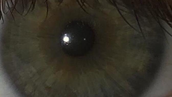 Is the person who asked about my eyes still here?