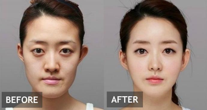 Would you mind if your partner wasn’t a natural beauty?