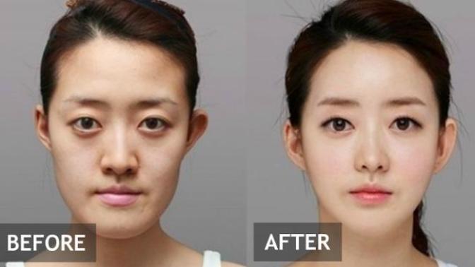 Would you mind if your partner wasn’t a natural beauty?