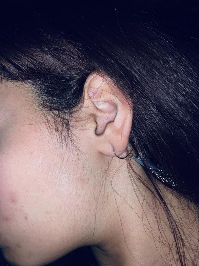 Are guys okay with dating a girl that has dark upper lip hair, hair in between her brows she removes both and little side face hair not removed?