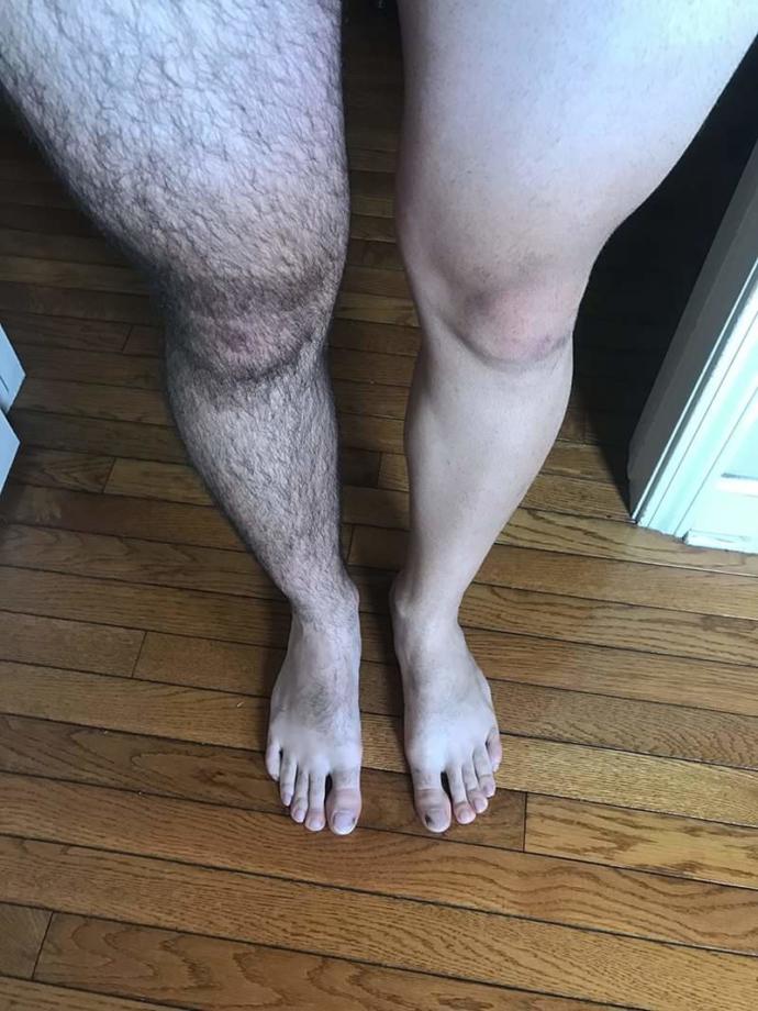 Men removing leg and arm hair?