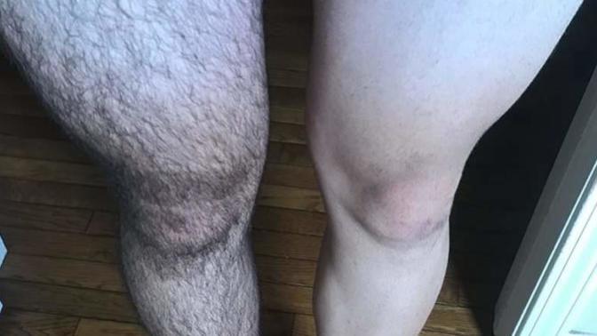 Men removing leg and arm hair?