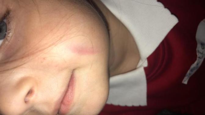 My cousin is physically hurting my three year old, what do I do?