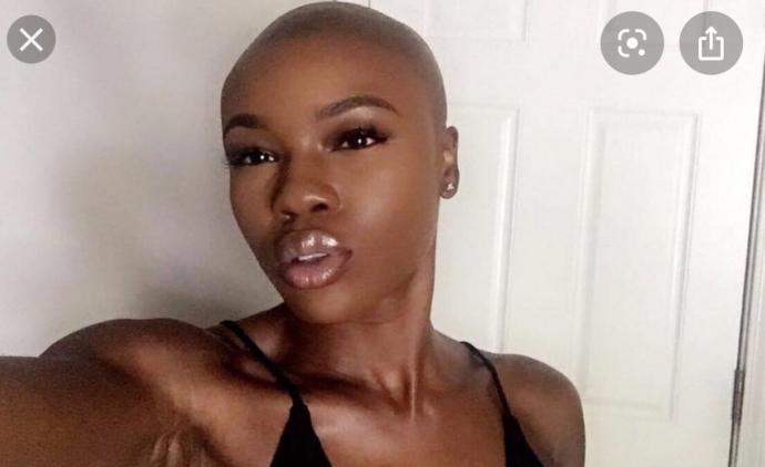 Do guys find bald girls attractive?