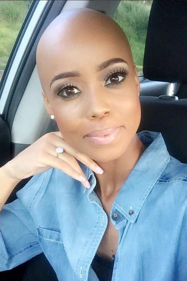 Do guys find bald girls attractive?